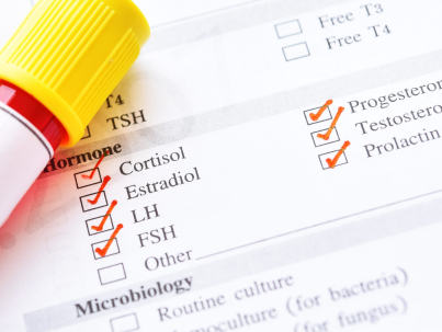 hormone tests