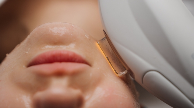 facial laser treatment