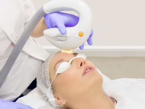 facial laser treatment