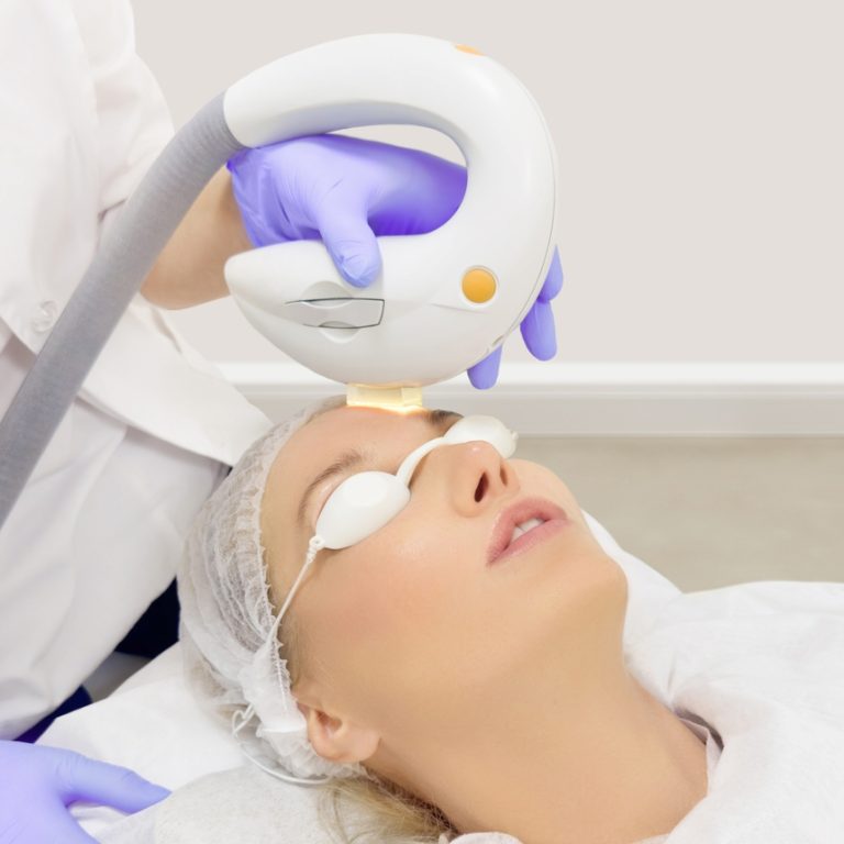 facial laser treatment